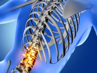 iteracareprife-produk-06