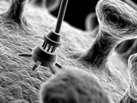 purtierplacentarusa-technology-01